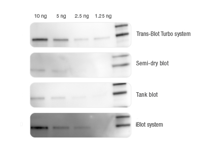 BIO-RAD Trans-Blot®Turbo<strong><strong><strong><strong><strong>美國伯樂<strong>全能型蛋白轉印系統</strong>1704150</strong></strong></strong></strong></strong>