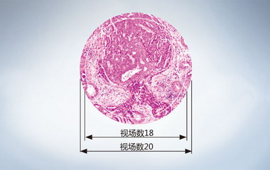 Olympus奥林巴斯显微镜